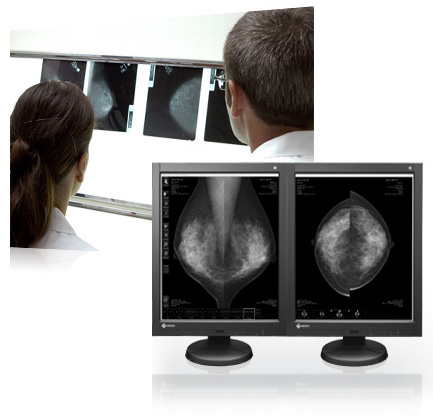 Film to Filmless Mammography Diagnosis